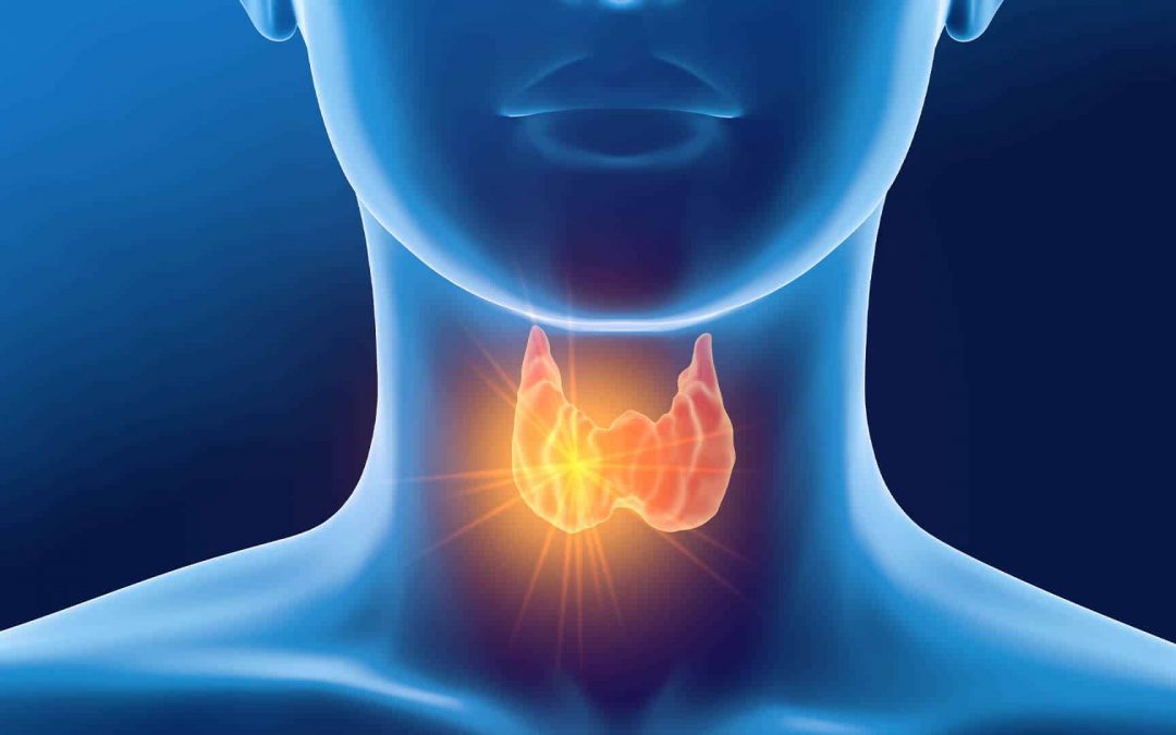 Hyperthyroidism