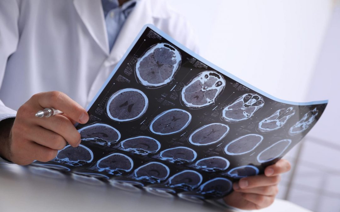 Is Radiation exposure ( X-rays, cone beam CT scans) is it bad for us? Could it be beneficial?