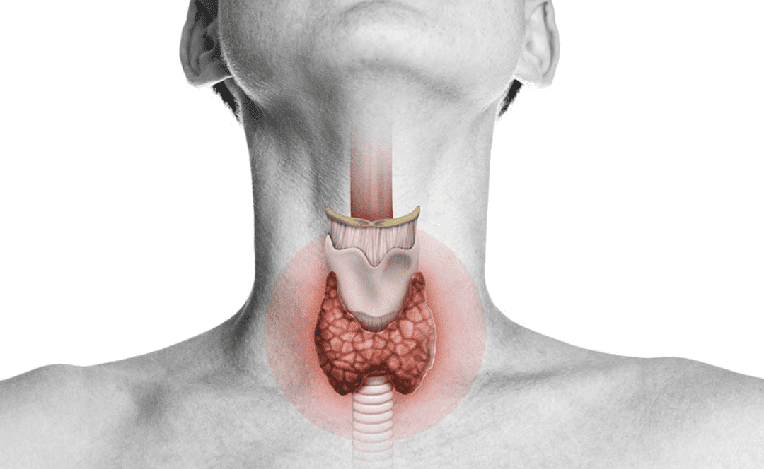 Hypothyroidism